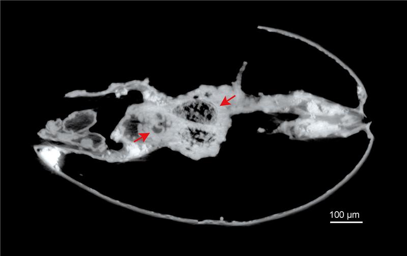 ostracod Harbinia micropapillosa tomography